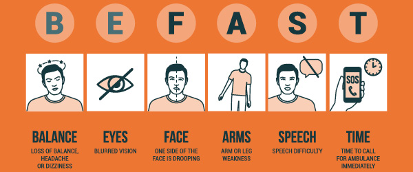 When it Comes to Recognizing a Stroke, B.E. F.A.S.T.