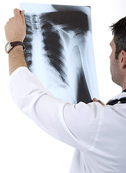 Male doctor looking at x-rays.